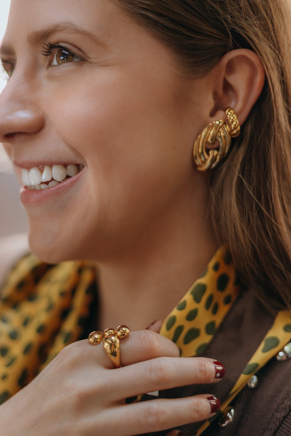 Aretes